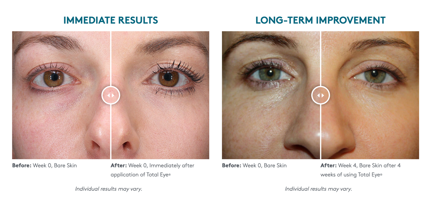 ColorScience Total Eye® 3-In-1 Renewal Therapy SPF 35