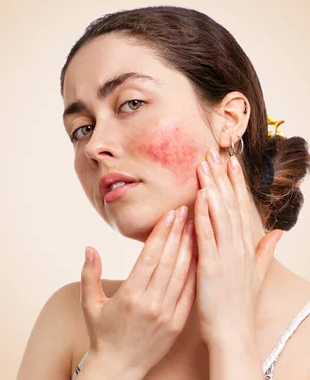 Redness Relief Collection