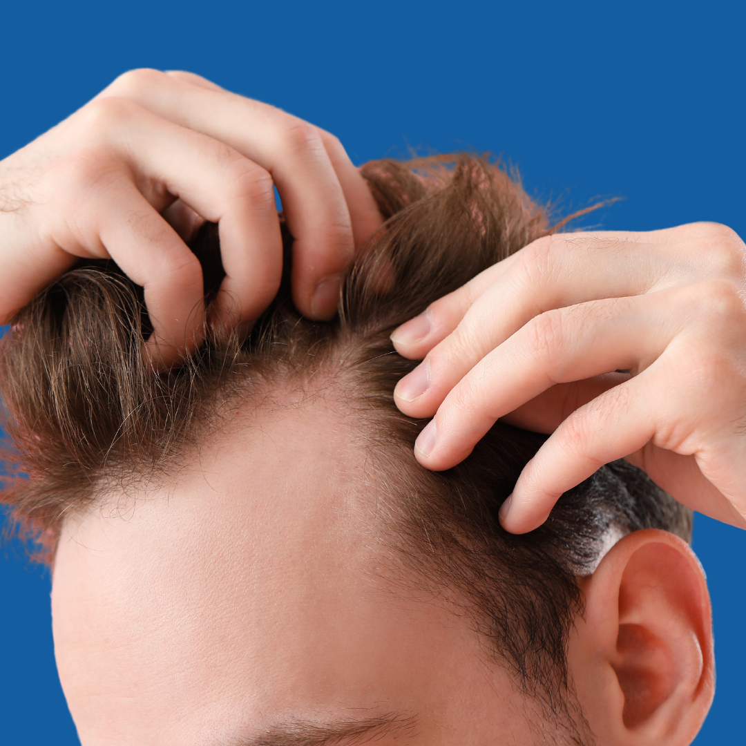 Hair Loss Care Collection