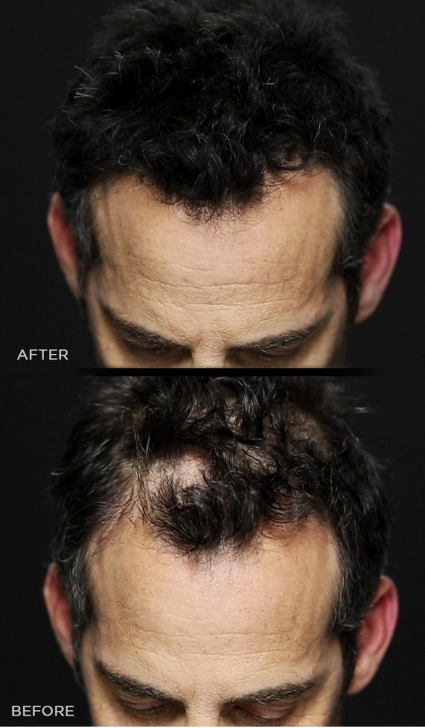 Toppik Hair Building Fibers
