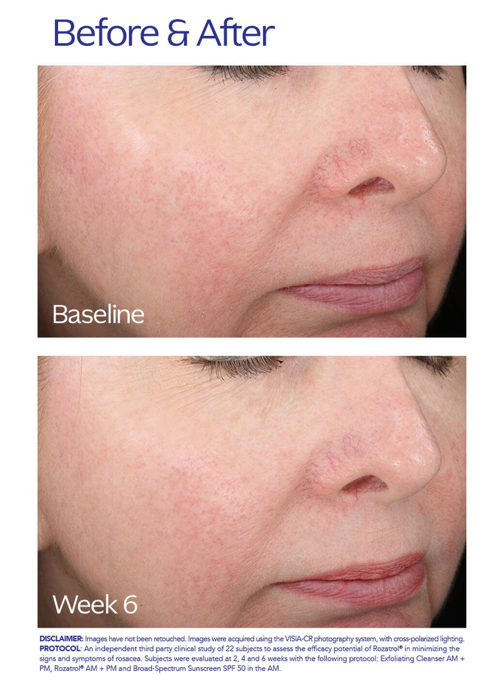 ZO Skincare Rozatrol®