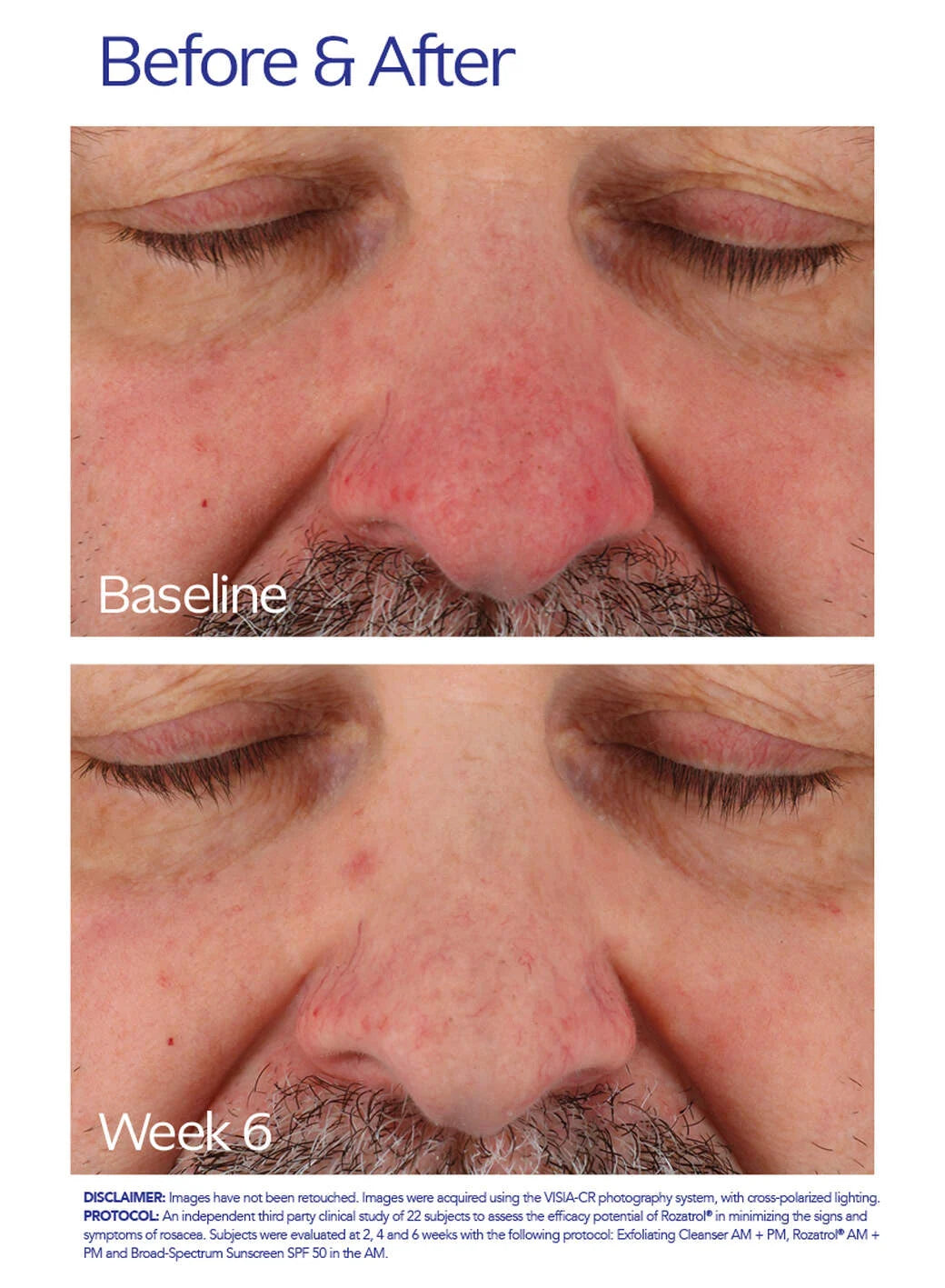 ZO Skincare Rozatrol®